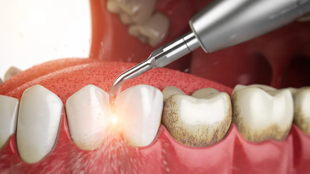 Gum Treatment