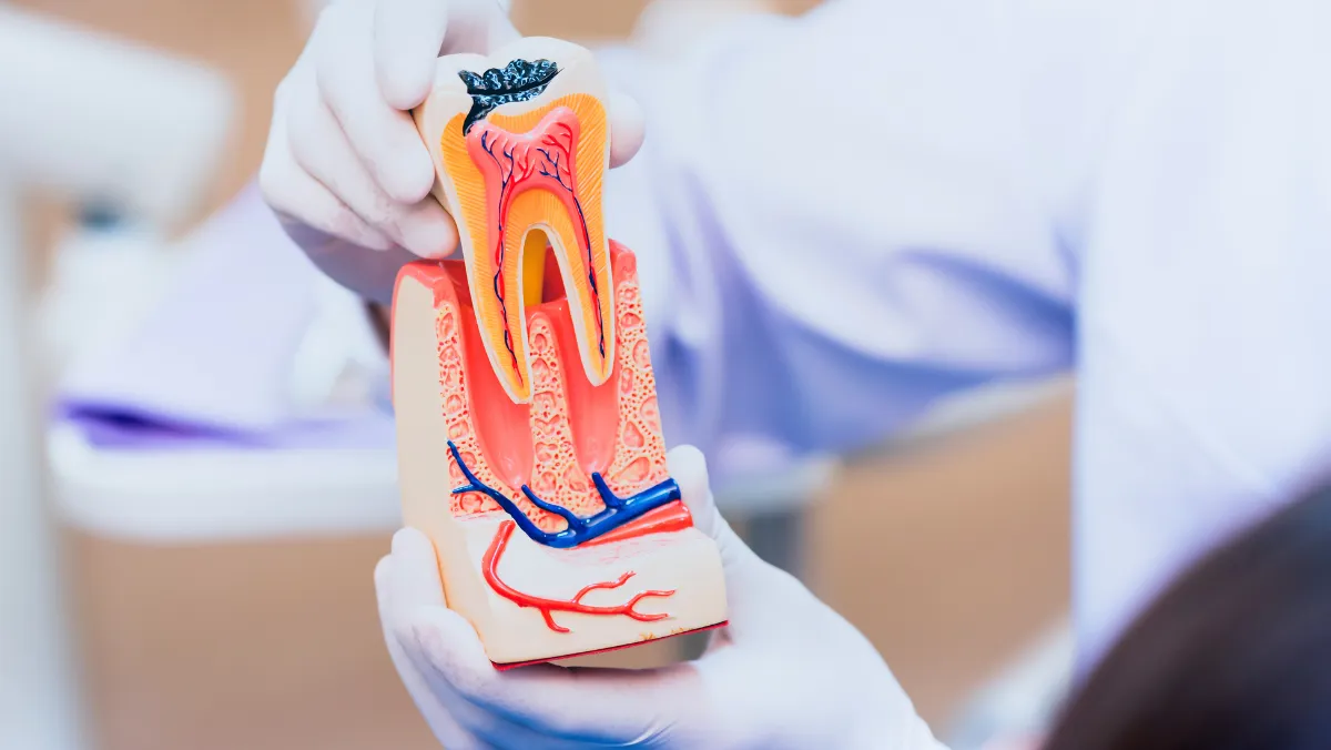 Root Canal Treatment