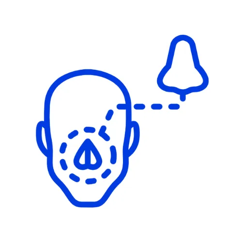 Sinus Lifting