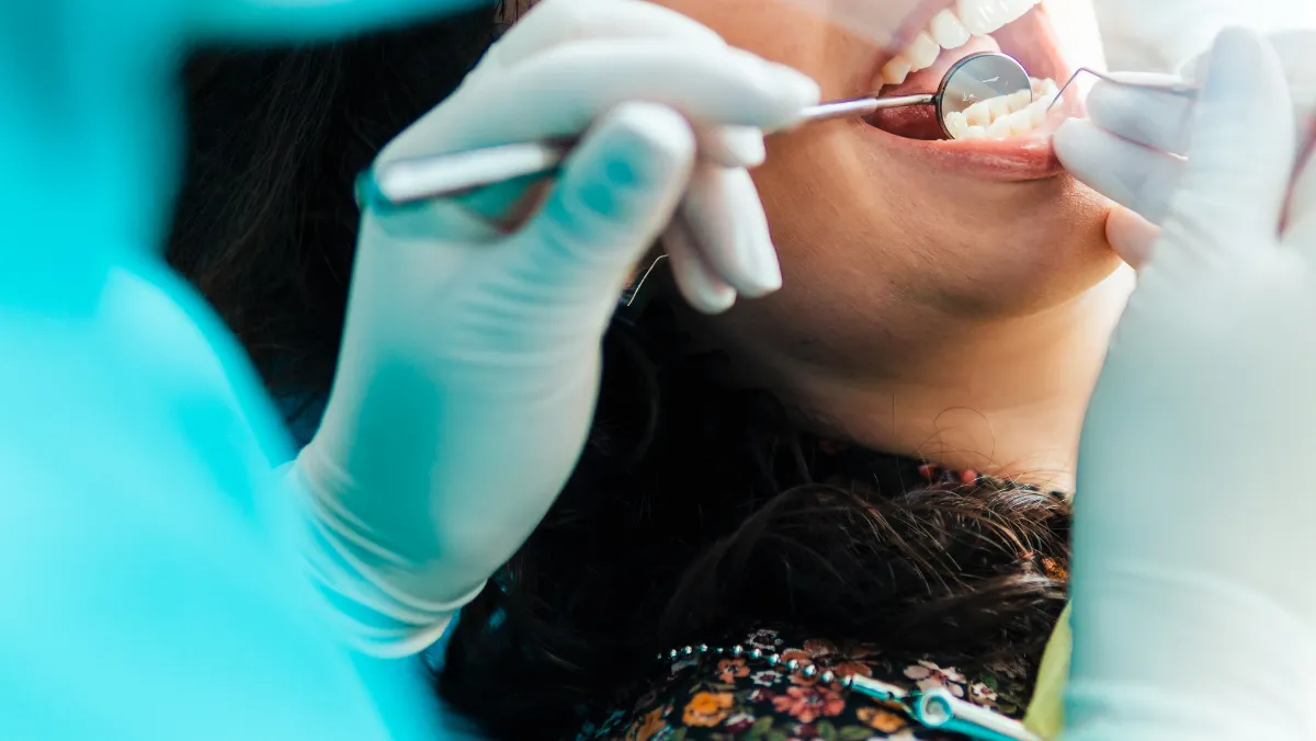 Sub Gingival Curretage