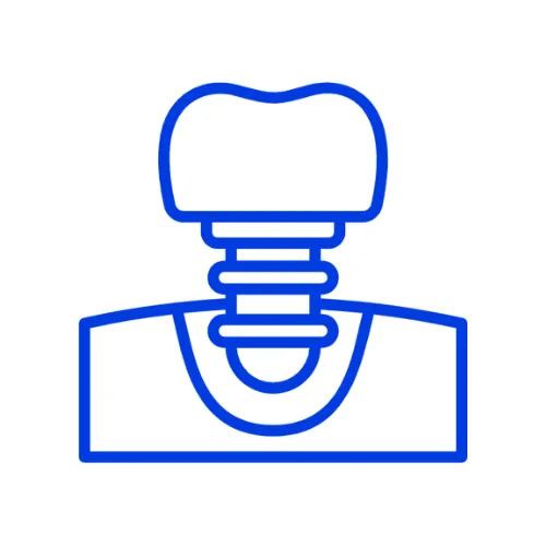 Zygoma Implants